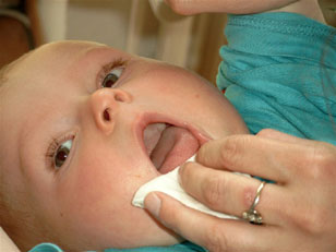 Die erste Zähne - eine kritische Zeit für das Baby